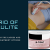 Cellulite Explained: Causes & Treatment Options