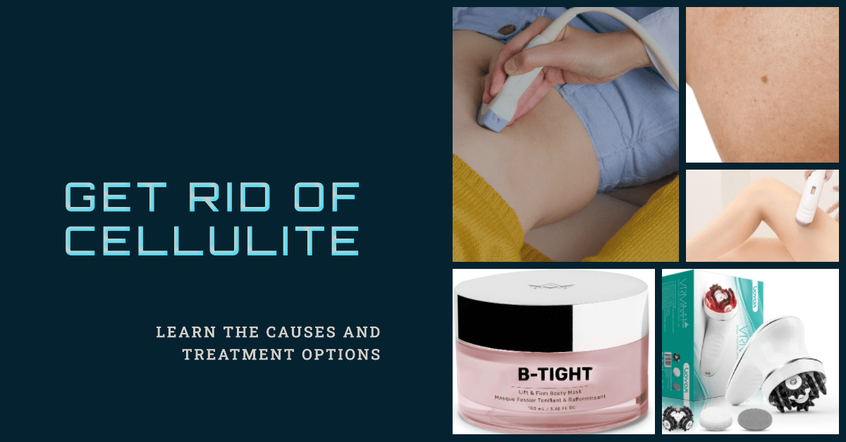 Cellulite Explained: Causes & Treatment Options